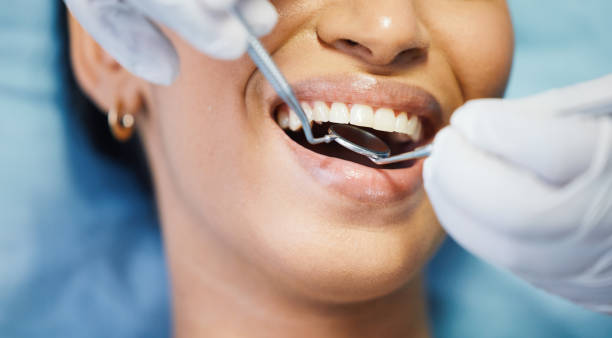 Best Emergency Tooth Extraction in Moville, IA