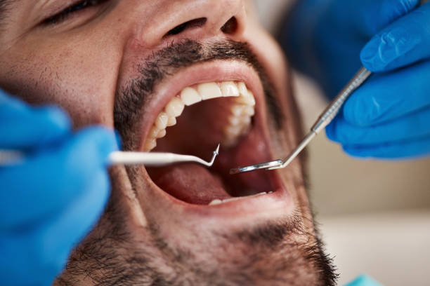Best Emergency Dental Care for Broken or Chipped Teeth in Moville, IA